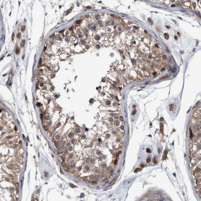 ITIH3 Antibody in Immunohistochemistry (Paraffin) (IHC (P))