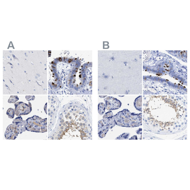 TSGA2 Antibody in Immunohistochemistry (IHC)