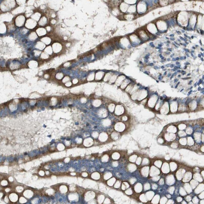 MGAT3 Antibody in Immunohistochemistry (IHC)