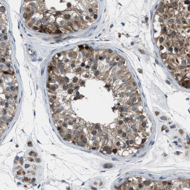 CLEC2D Antibody in Immunohistochemistry (Paraffin) (IHC (P))