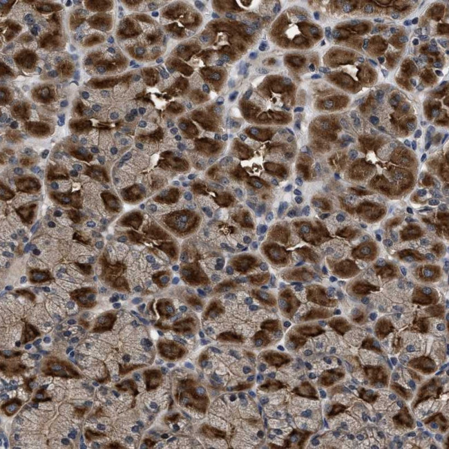 DNAJC14 Antibody in Immunohistochemistry (Paraffin) (IHC (P))