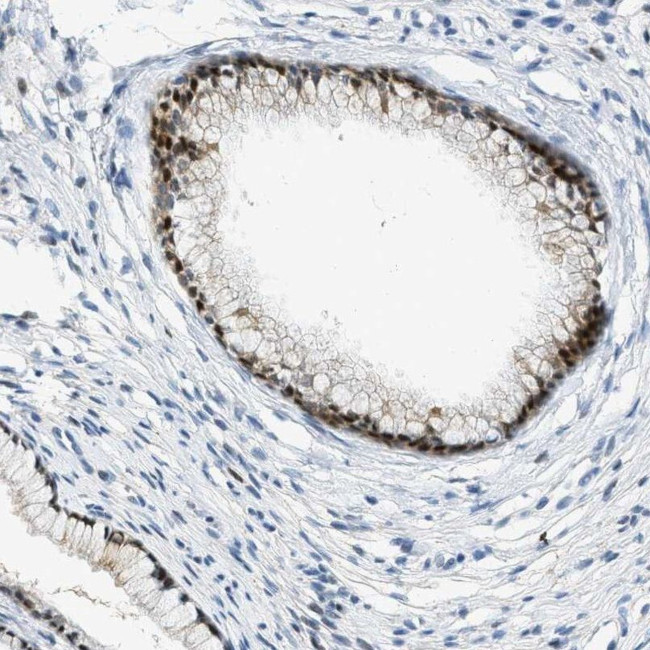 CYP4X1 Antibody in Immunohistochemistry (IHC)