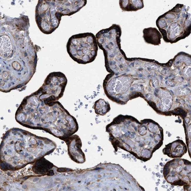 TMEM131 Antibody in Immunohistochemistry (Paraffin) (IHC (P))