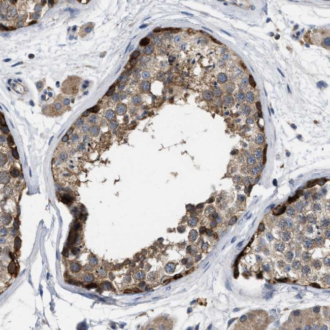 TMEM131 Antibody in Immunohistochemistry (Paraffin) (IHC (P))