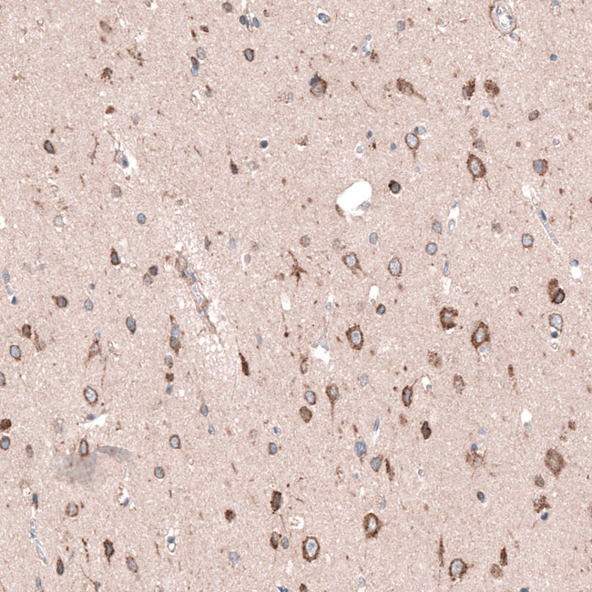 SGEF Antibody in Immunohistochemistry (Paraffin) (IHC (P))