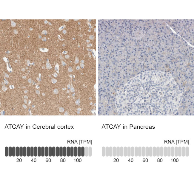 ATCAY Antibody in Immunohistochemistry (IHC)