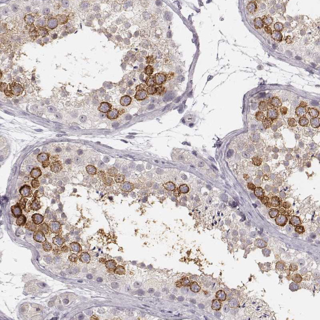 LY6K Antibody in Immunohistochemistry (Paraffin) (IHC (P))