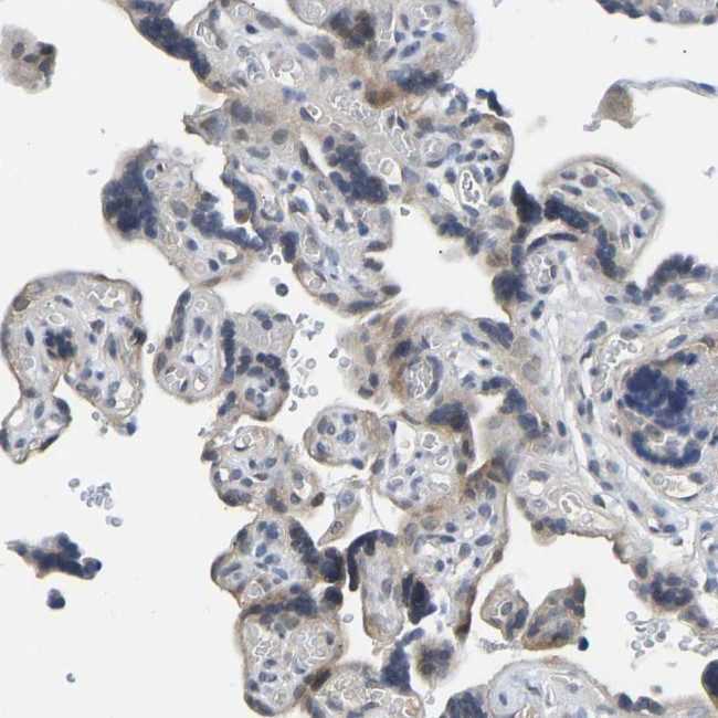 NDRG3 Antibody in Immunohistochemistry (Paraffin) (IHC (P))