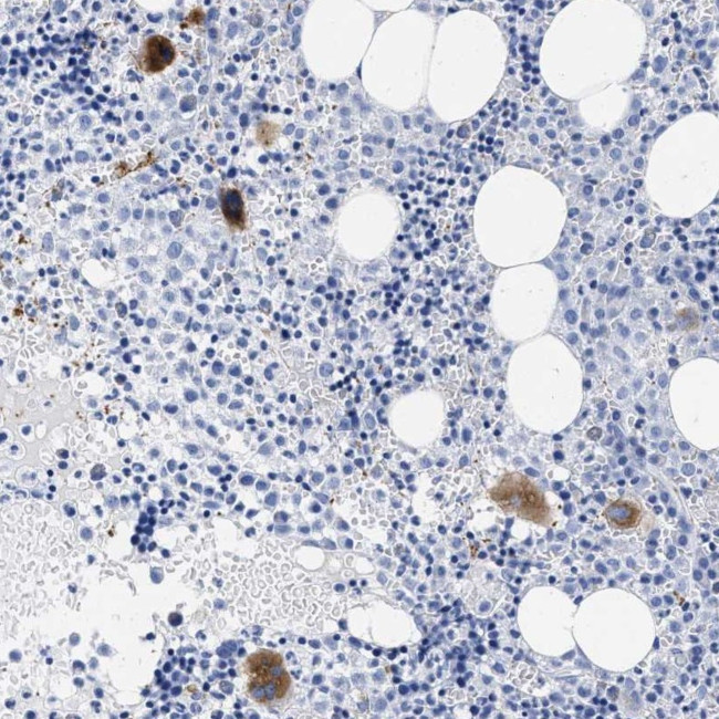 TREML1 Antibody in Immunohistochemistry (Paraffin) (IHC (P))