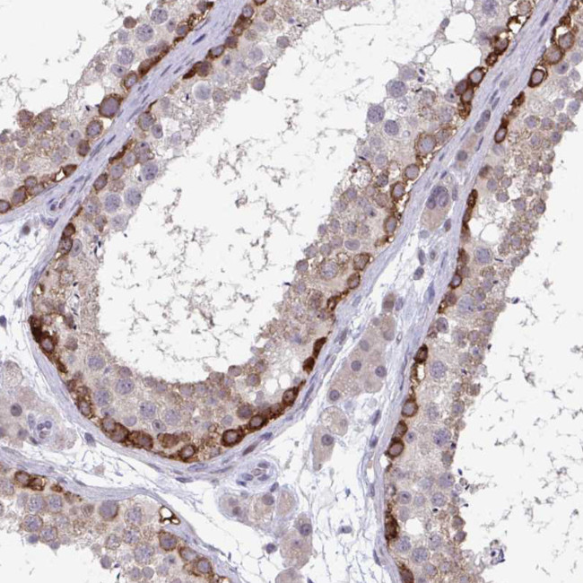 RIOK1 Antibody in Immunohistochemistry (Paraffin) (IHC (P))