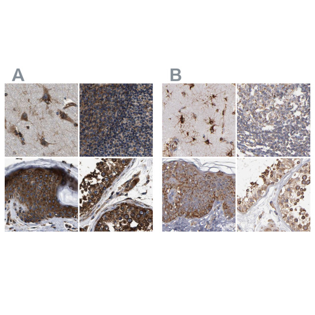 KTN1 Antibody in Immunohistochemistry (IHC)
