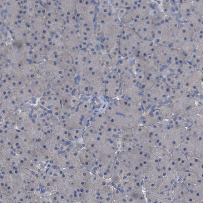 GPR179 Antibody in Immunohistochemistry (Paraffin) (IHC (P))