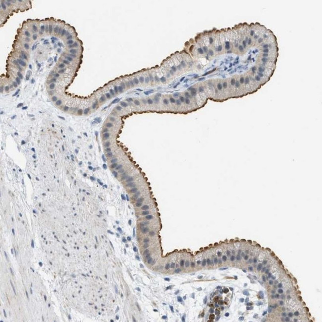 ZNF408 Antibody in Immunohistochemistry (IHC)