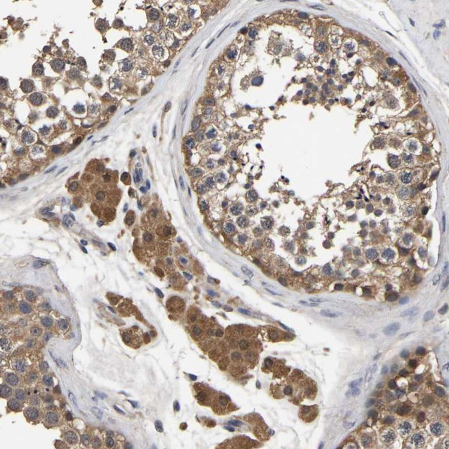 STK32C Antibody in Immunohistochemistry (Paraffin) (IHC (P))