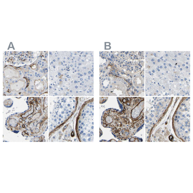 COL15A1 Antibody in Immunohistochemistry (IHC)