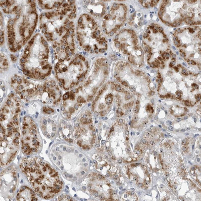 PDCD11 Antibody in Immunohistochemistry (Paraffin) (IHC (P))