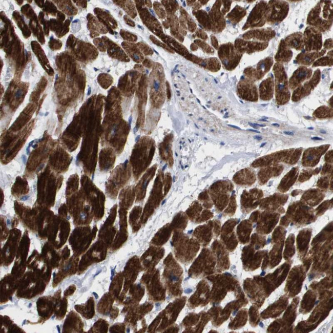 SHD Antibody in Immunohistochemistry (Paraffin) (IHC (P))