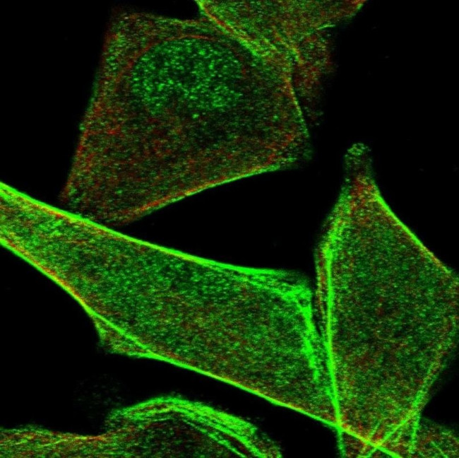 PALMD Antibody in Immunocytochemistry (ICC/IF)