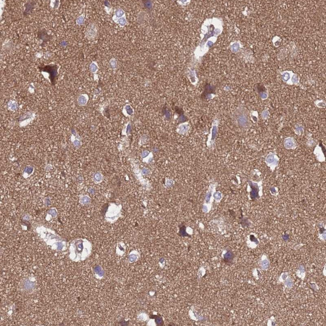 SGIP1 Antibody in Immunohistochemistry (Paraffin) (IHC (P))