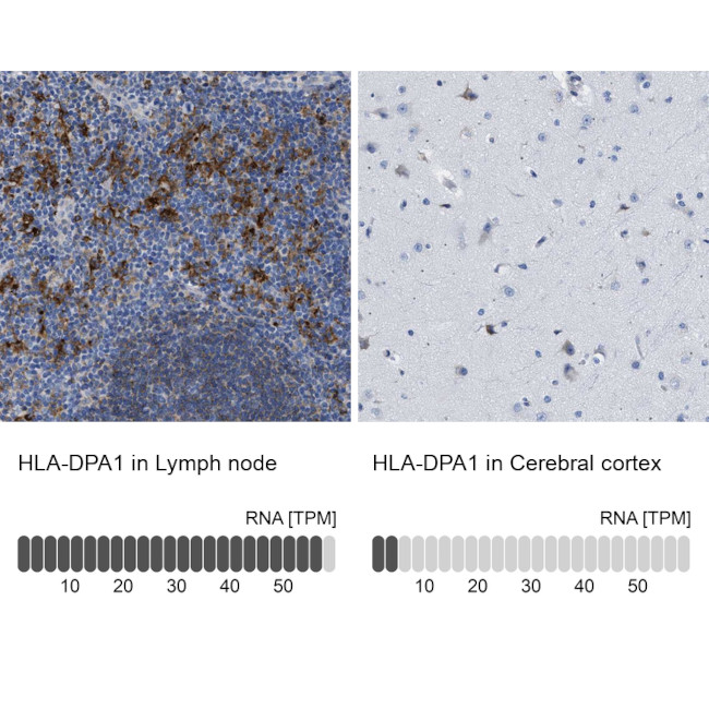 HLA-DPA1 Antibody in Immunohistochemistry (IHC)