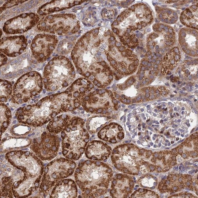 PLEKHG2 Antibody in Immunohistochemistry (IHC)