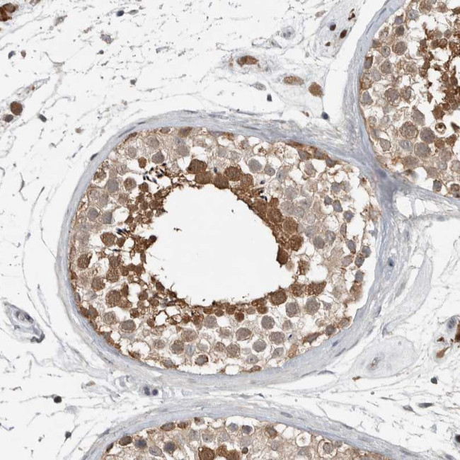 MFAP3L Antibody in Immunohistochemistry (Paraffin) (IHC (P))