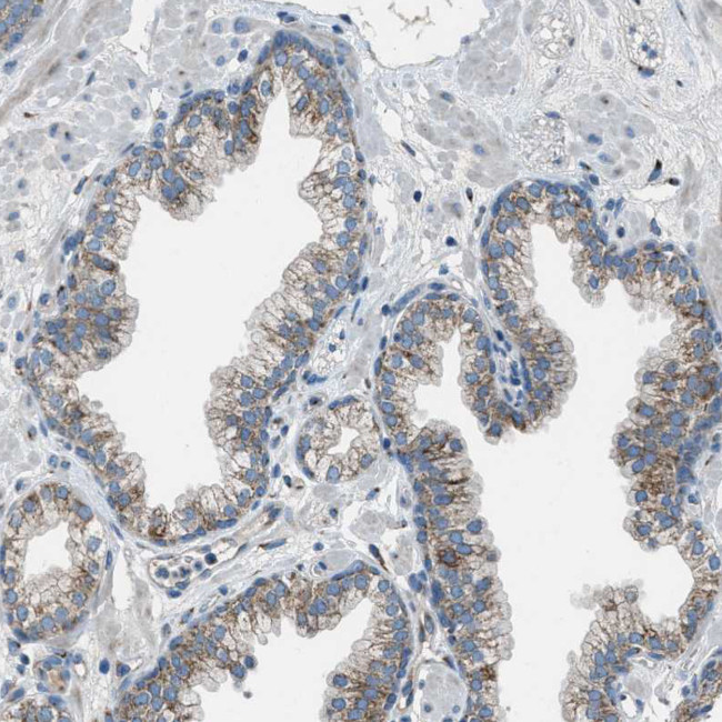 BCKDK Antibody in Immunohistochemistry (Paraffin) (IHC (P))