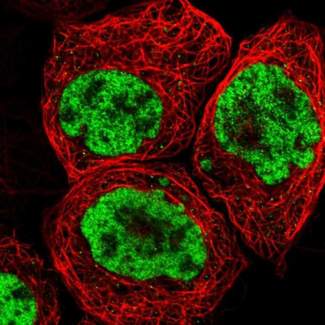 FOXK1 Antibody in Immunocytochemistry (ICC/IF)