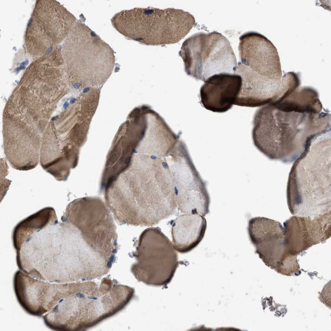 ITSN1 Antibody in Immunohistochemistry (Paraffin) (IHC (P))