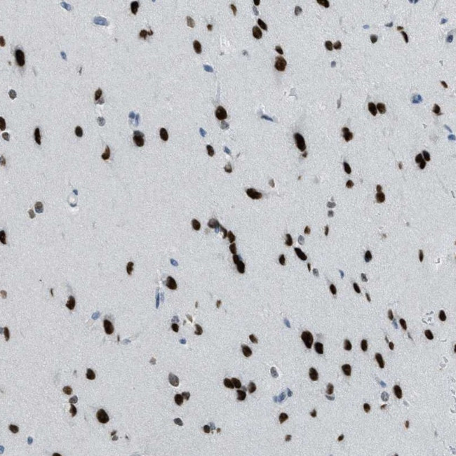 TTC13 Antibody in Immunohistochemistry (Paraffin) (IHC (P))
