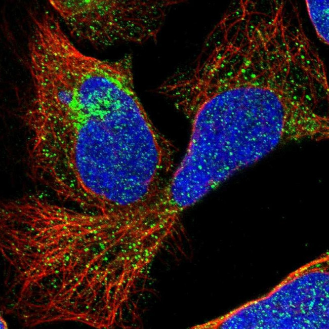 TMEM180 Antibody in Immunocytochemistry (ICC/IF)