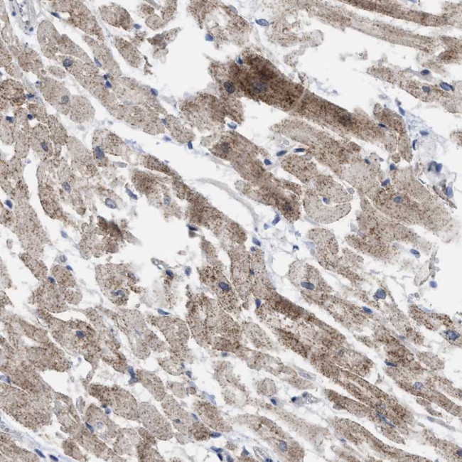 TMEM159 Antibody in Immunohistochemistry (Paraffin) (IHC (P))
