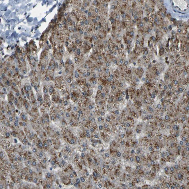 SVOPL Antibody in Immunohistochemistry (Paraffin) (IHC (P))