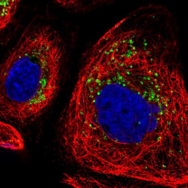 DRAM2 Antibody in Immunocytochemistry (ICC/IF)