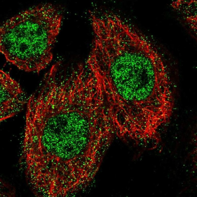 ZNF449 Antibody in Immunocytochemistry (ICC/IF)