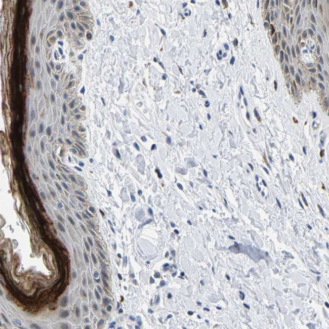 C14orf177 Antibody in Immunohistochemistry (Paraffin) (IHC (P))