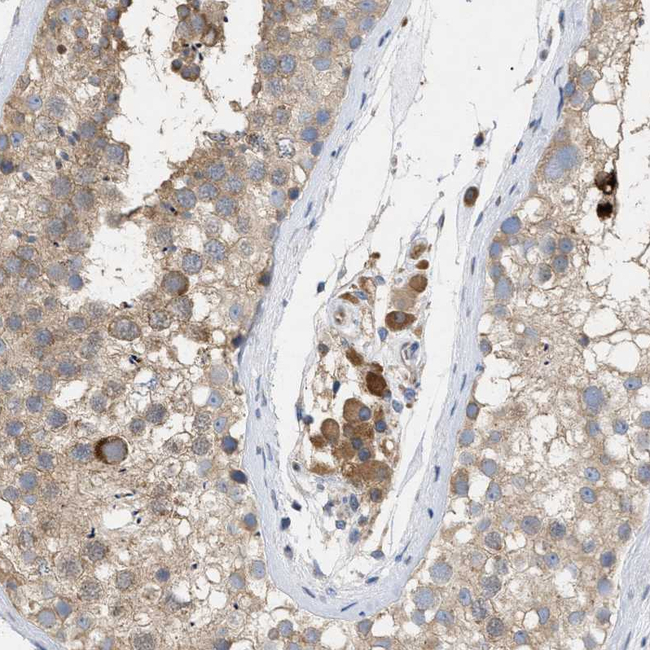 SLC50A1 Antibody in Immunohistochemistry (Paraffin) (IHC (P))