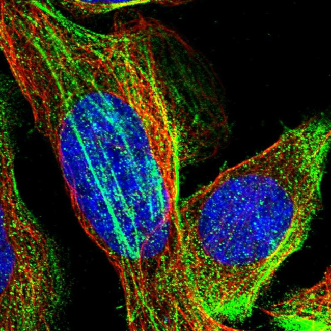 TMEM17 Antibody in Immunocytochemistry (ICC/IF)