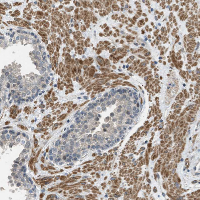 TTBK2 Antibody in Immunohistochemistry (Paraffin) (IHC (P))