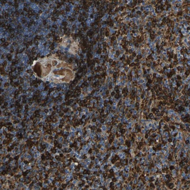 PIGS Antibody in Immunohistochemistry (IHC)