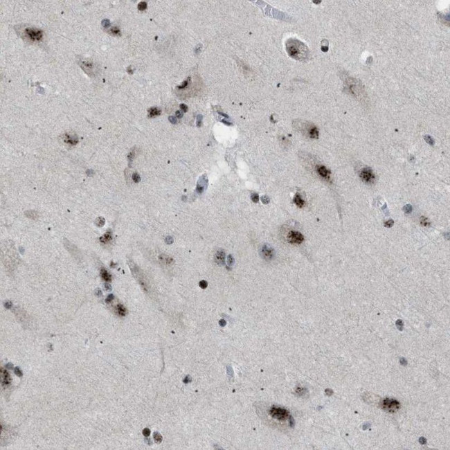 CDR2 Antibody in Immunohistochemistry (IHC)