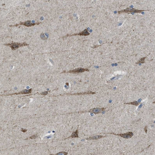 PAFAH2 Antibody in Immunohistochemistry (Paraffin) (IHC (P))