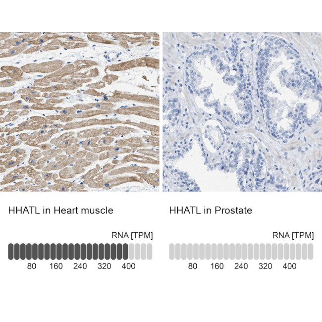 HHATL Antibody in Immunohistochemistry (IHC)