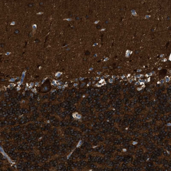 ZSWIM5 Antibody in Immunohistochemistry (Paraffin) (IHC (P))