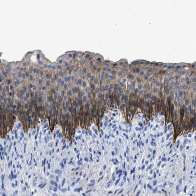 TMEM68 Antibody in Immunohistochemistry (IHC)