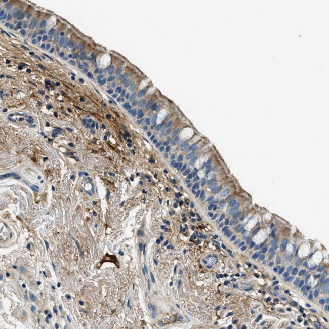 TMEM186 Antibody in Immunohistochemistry (Paraffin) (IHC (P))
