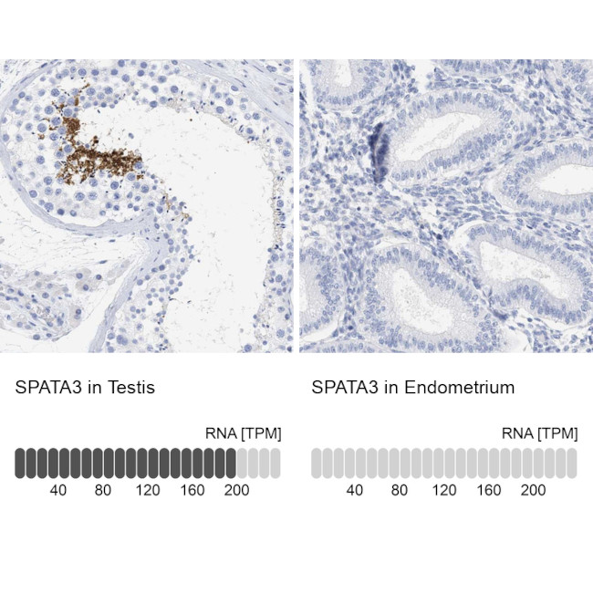 SPATA3 Antibody in Immunohistochemistry (IHC)