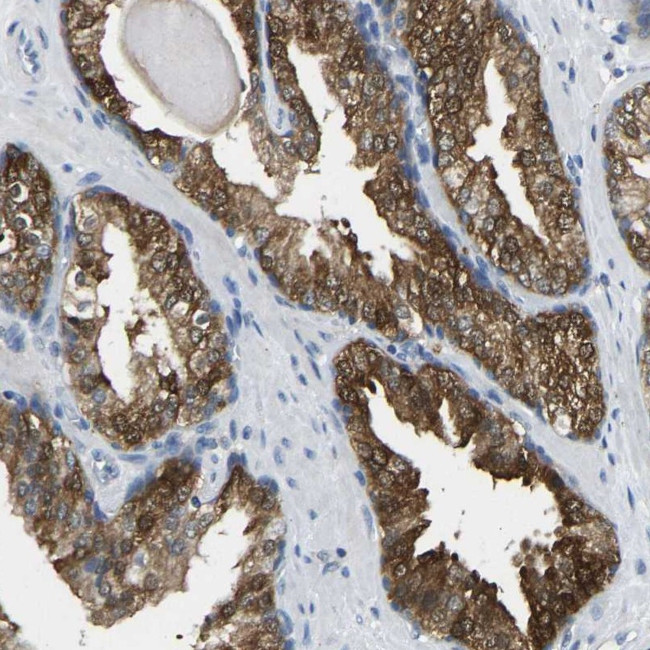 NDRG3 Antibody in Immunohistochemistry (Paraffin) (IHC (P))