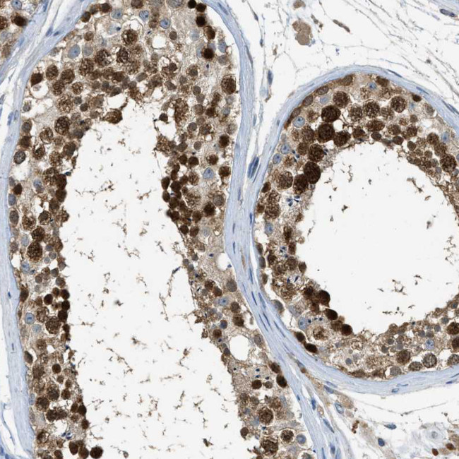 MIS18A Antibody in Immunohistochemistry (Paraffin) (IHC (P))