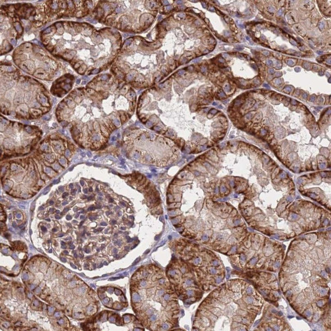 ZNF248 Antibody in Immunohistochemistry (IHC)